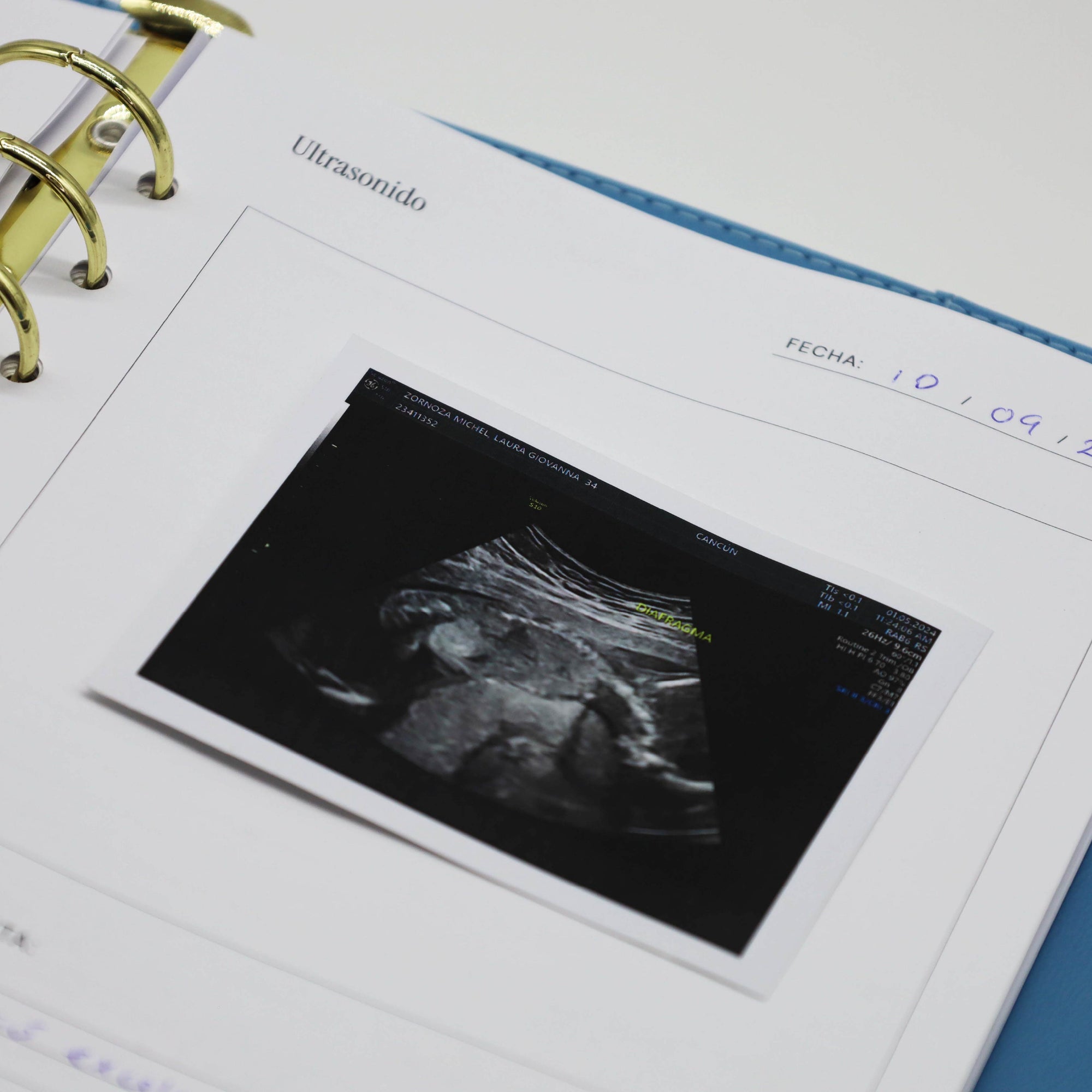 Pregnancy Journal