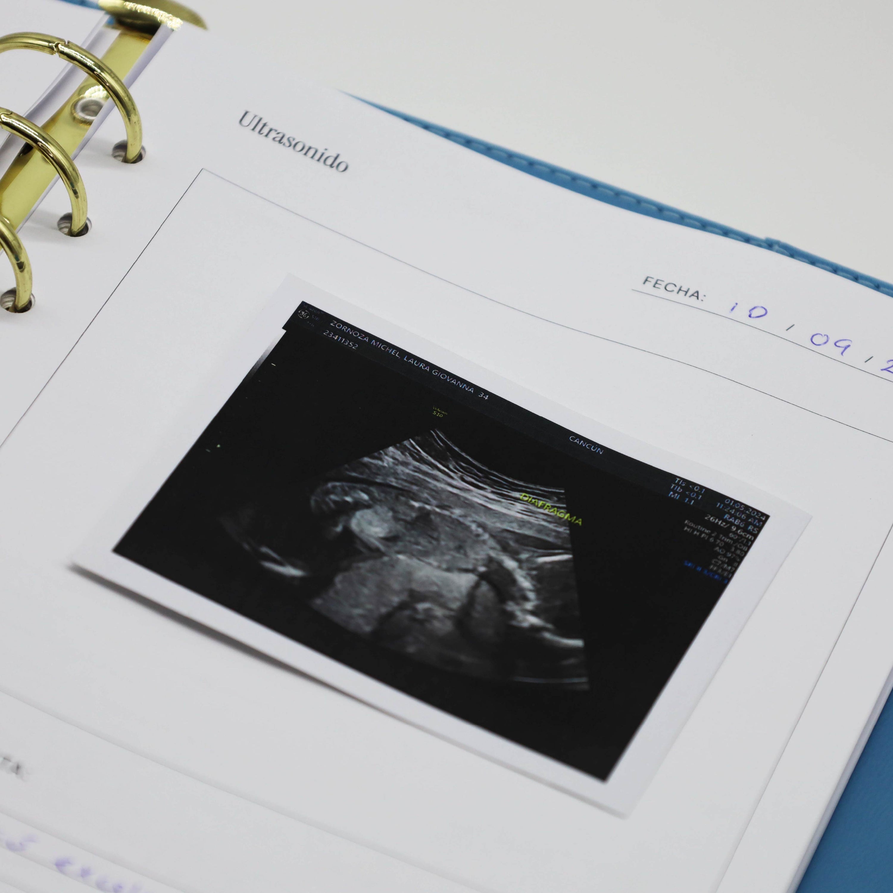 Bundle Pregnancy Journal